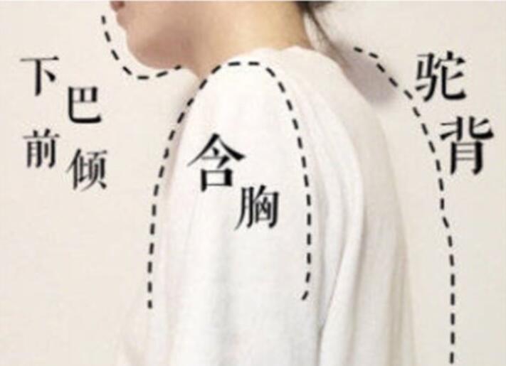 南寧美容學校：堅持一個月，駝背變直背