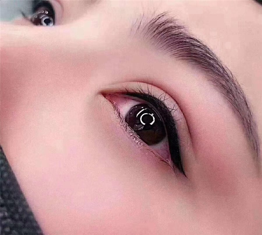 紋繡技巧：紋繡過后多久恢復(fù)正常