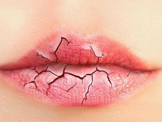 6個(gè)美容技巧，解決秋季嘴唇干燥