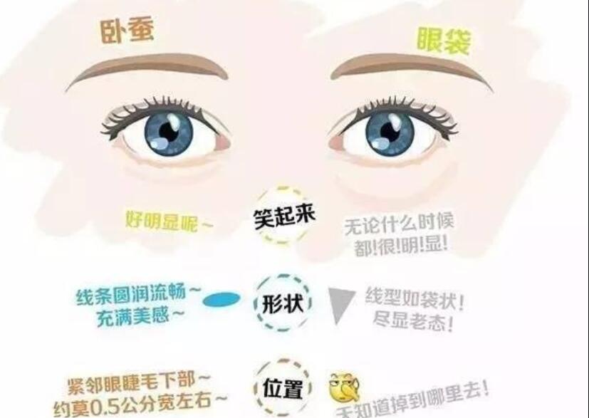 眼袋還是臥蠶，快來學(xué)辨別的方法