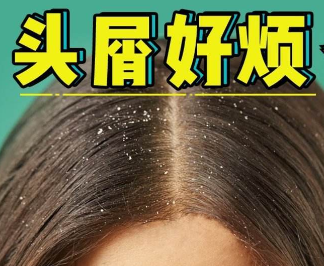 南寧正規(guī)美發(fā)培訓(xùn)學(xué)校分享：冬天如何減少頭屑過多？