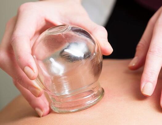 4種不同的拔罐方法，廣西美容學校整理好了