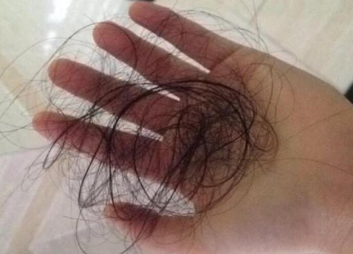 脫發(fā)女孩必備寶典！南寧美發(fā)學(xué)校教你