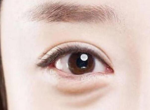眼袋？淚溝？臥蠶？南寧美容學(xué)校教你辨別