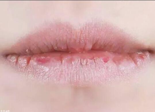 紋唇后嘴巴干燥怎么辦？南寧教紋繡的學(xué)校幫你解決