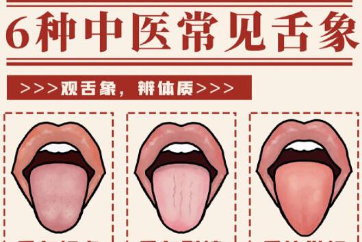 6種常見(jiàn)中醫(yī)舌診判定，快和廣西中醫(yī)美容一起學(xué)