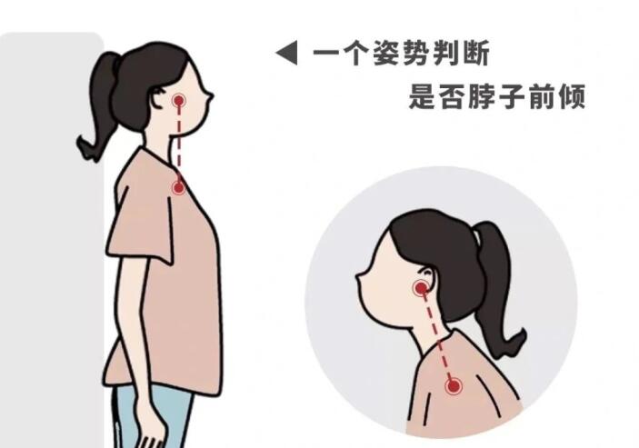 南寧學美容養(yǎng)生的學校：如何改善脖子前傾