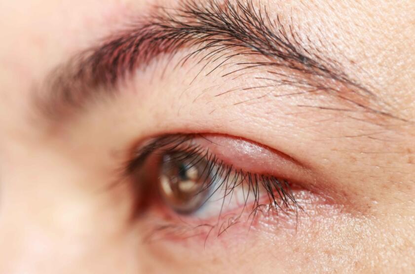 學(xué)紋繡理論知識(shí)：認(rèn)識(shí)“壞眉”分類