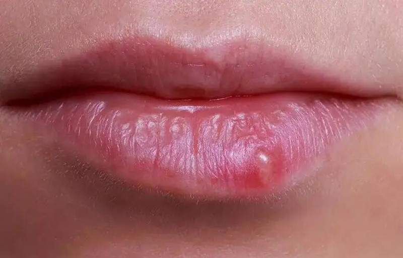 紋唇后起泡怎么辦？南寧紋唇培訓(xùn)學(xué)校教你方法
