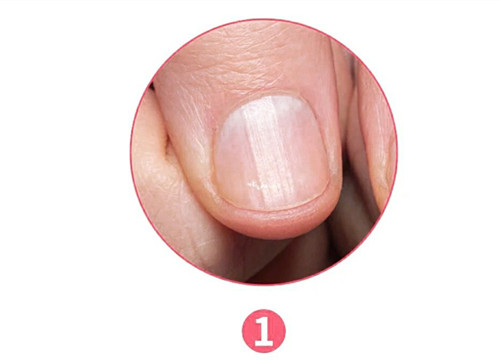 女生氣血不足六大表現(xiàn)，南寧美容養(yǎng)生資訊報道