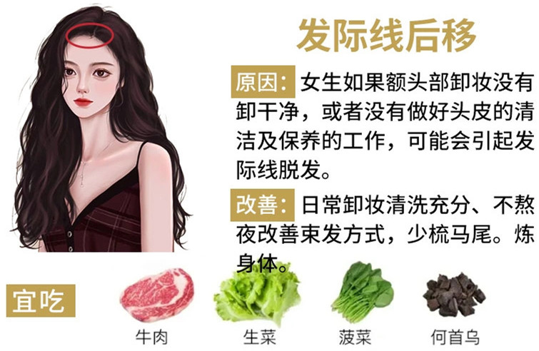 如何改善掉頭發(fā)？南寧頭療養(yǎng)發(fā)護(hù)發(fā)教學(xué)