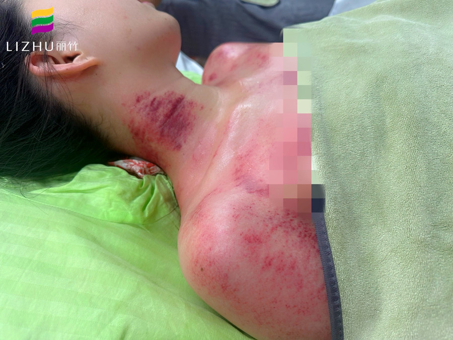 廣西學(xué)刮痧培訓(xùn)班 | 廣西學(xué)刮痧學(xué)費(fèi)多少？