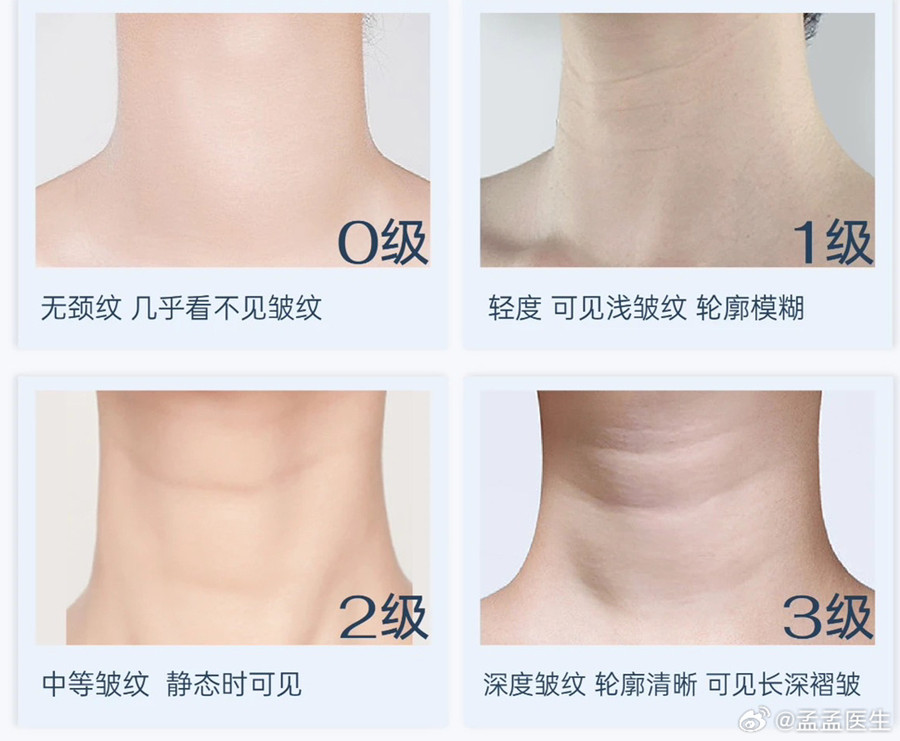 如何緩解頸紋？南寧美體美容管理培訓(xùn)