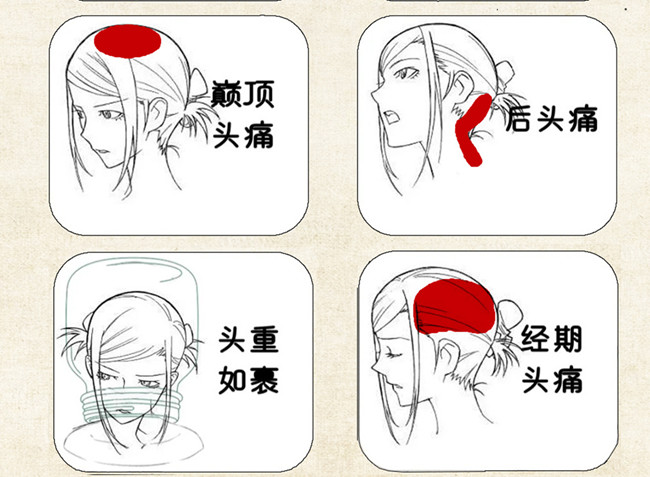 不同頭痛類型經絡護理方法，廣西中醫(yī)美容培訓