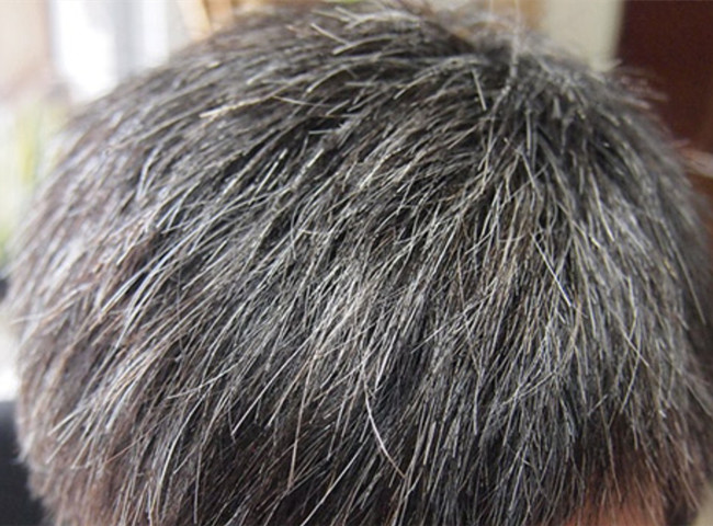 南寧美發(fā)基礎(chǔ)教學(xué)：為什么會(huì)長(zhǎng)白頭發(fā)？