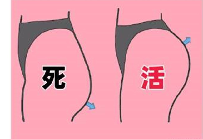 如何改善你臀部的健康情況？南寧美容形象