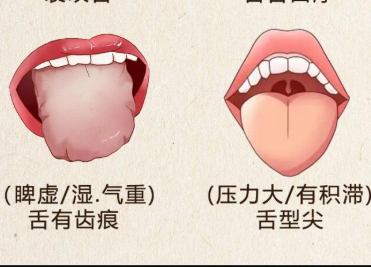 如何根據舌苔看健康 | 廣西美容美體培訓哪里正規(guī)
