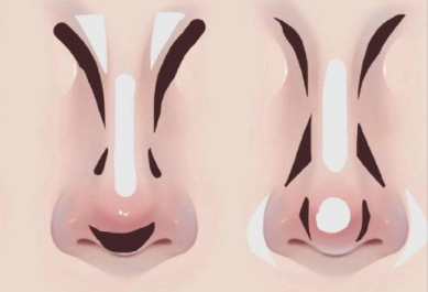 廣西習(xí)化妝排名：不同鼻型如何修容？